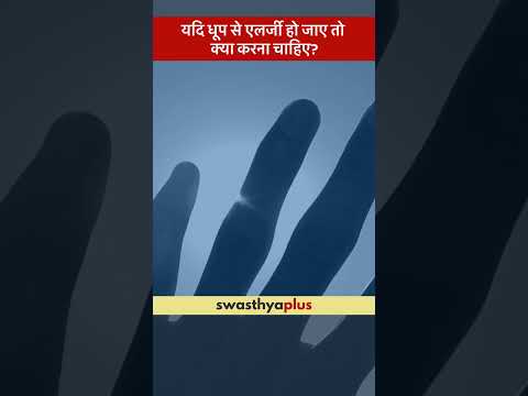 यदि धूप से एलर्जी हो जाए तो क्या करना चाहिए? | Sun Allergy: How to manage? | Dr M Padam Kumar