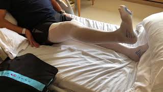 Conformis iTotal CR 31 7 18   Day 3 post op