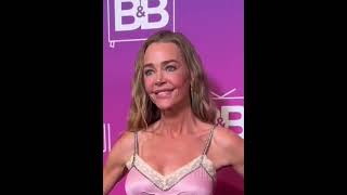 How's the Denise Richards smile holding up?  Can it be undone?