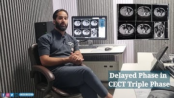 Delayed Phase | CECT Triple Phase | By Anis Qureshi
