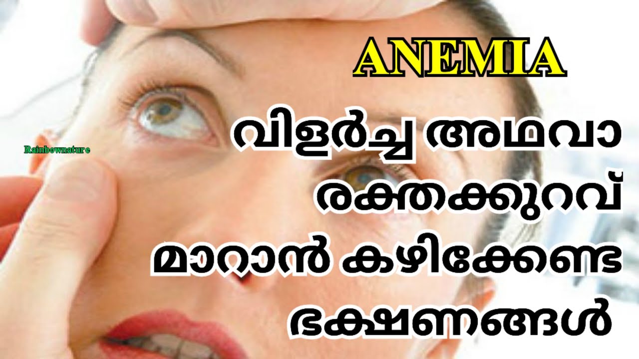 വിളർച്ച അഥവാ രക്തക്കുറവ് മാറാൻ കഴിക്കേണ്ട ഭക്ഷണങ്ങൾ.anemia,വിളർച്ച,