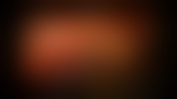 Robotic LUL Lobectomy & Previous LIMA Coronary Graft, narrated