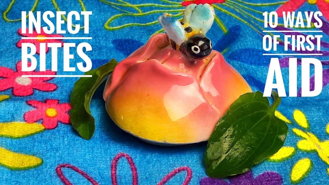 Top 10 Ways Of First Aid For Insect Bites By Home Remedies YouTube
