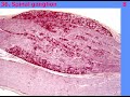 Histological preparations for the intermidiate Exam - 2  (34)