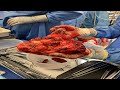 Tumours of the Cardiovascular System | Mindmap | Episode 44: Cardiovascular Pathology Series