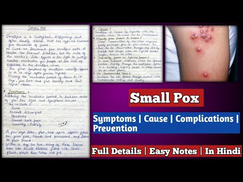 Small Pox | Small Pox - symptoms, causes, complications and prevention