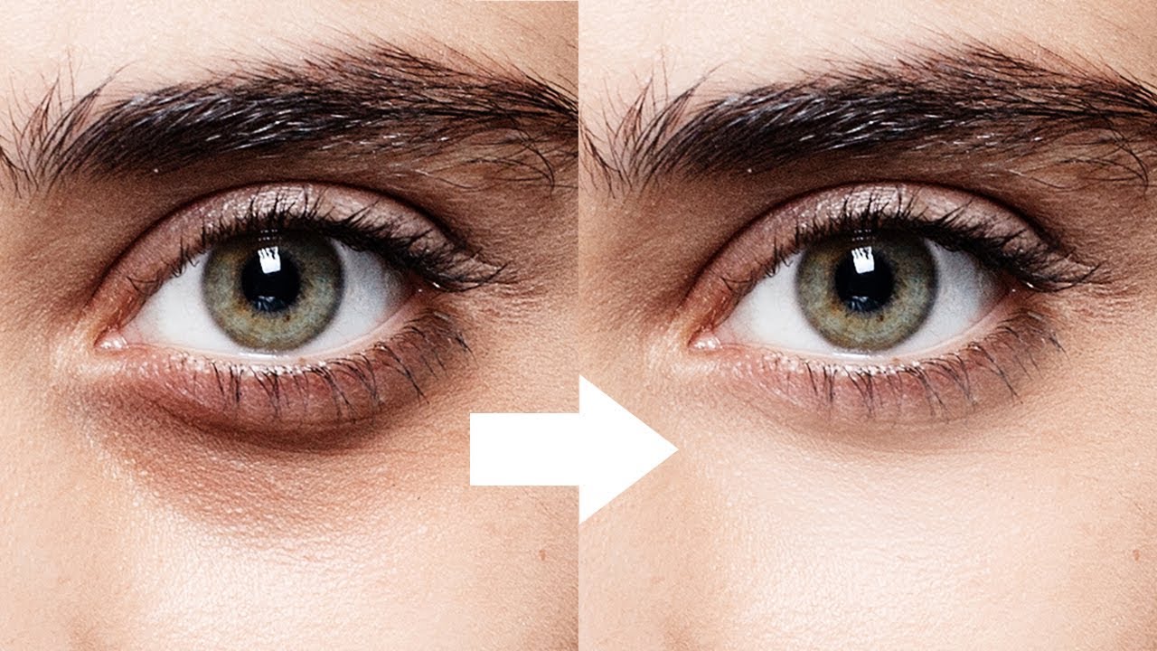 1-Minute Photoshop - Remove Dark Circles Naturally - YouTube