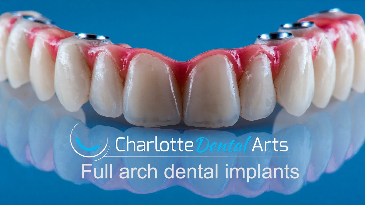 A Stable Solution to Dentures