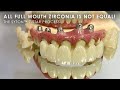 All Full Mouth Zirconia is not Equal!