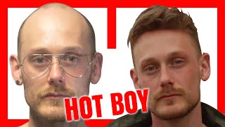 Cambio Epico Protesi Di Capelliprotesis Capilar Hair Replacement System