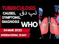 Tuberculosis ya Tapdaq kia ha | TB Urdu Hindi | HMusmanzia #hmusmanzia #TB