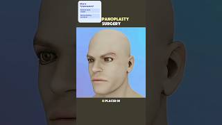 Tympanoplasty Surgery Procedure (3D Animation)