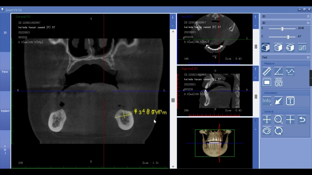 part 3 \  CBCT Workshop by Consultant Dr. Bashar