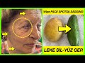 % 💯 Effective! My Aunt is 77 Years Old - WE WIPED DARK FACE SPOTS WITH POTATOES - STOP SAGGING FACE