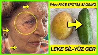 Mi Tía Tiene 77 Años-Limpiamos Las Manchas Oscuras De La Cara Con Papas-Detener La Flacidez De Cara