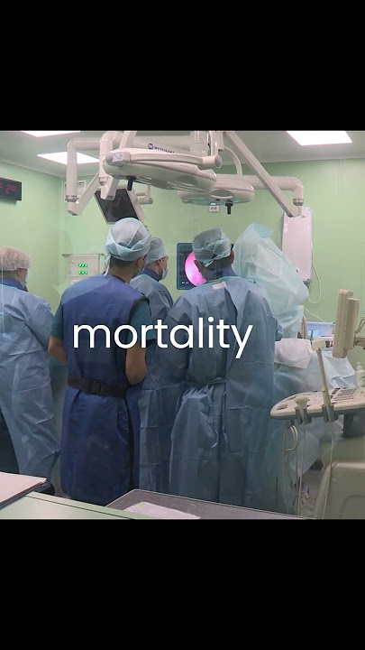 FAX You Didn't Need To Know... #shorts #facts #funny #fypシ