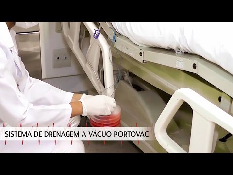 Vídeo: Dispositivo de drenagem para sistemas de drenagem