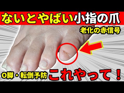 【簡単10秒だけ！】小指の爪がない人 O脚 “老化の赤信号”｜転倒・ひざ痛・寝たきり予防する方法