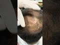 #waxing #ingrownhair #trending #hair #beard #remove #asmr #maazsafder #hairremoval #natural NK.0188