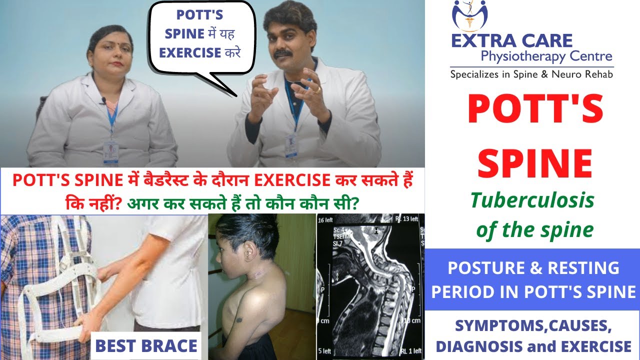 POTT'S SPINE TUBERCULOSIS of SPINE POSTURE, CAUSES, SYMPTOMS