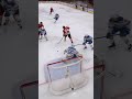 BIG LOUUUUUUUU🚨