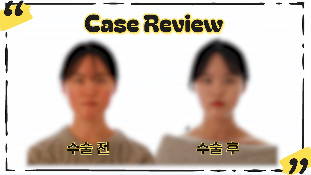 [멤버십 영상] case review - YouTube