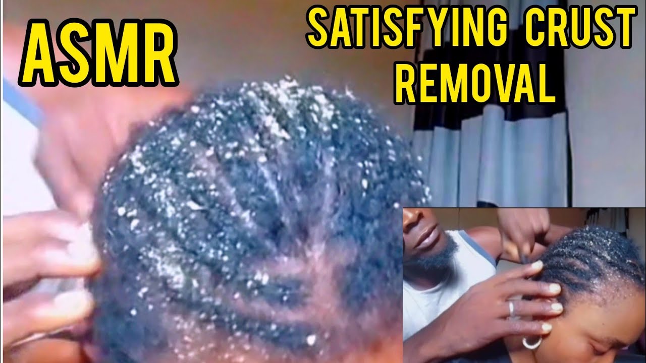 ASMR✨Soft gum, scalp blowin, hair crust scalp scratching on local braid,