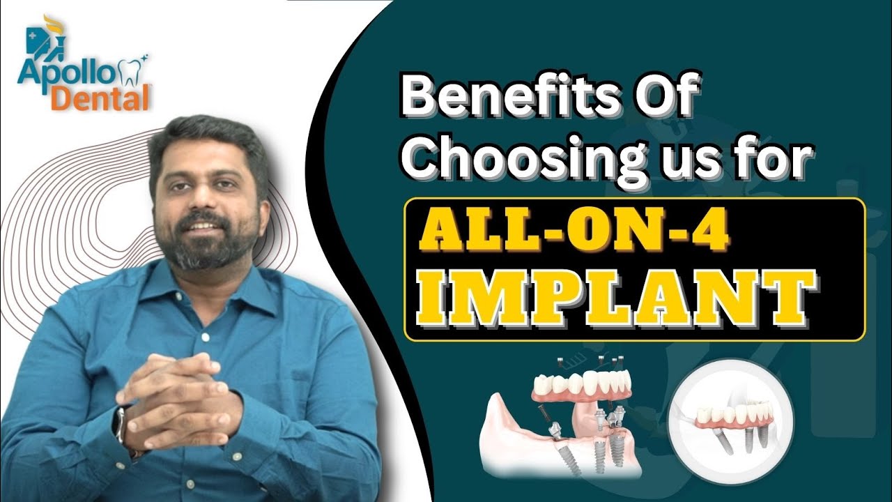 Why you should consider us for your All on Four Implants | Best All on Four Clinic in India |Dr Prem