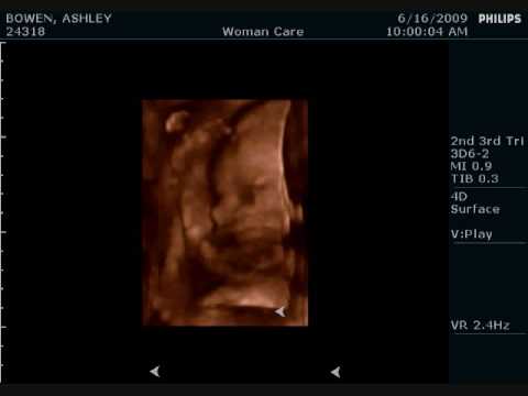 27 weeks 4D Ultrasound (Grant Thomas)