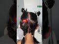 Увеличение затылка с индивидуальным имплантом | Occipital Augmentation with Custom Implant