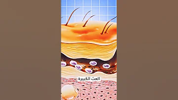 ماهو مرض الجرب 