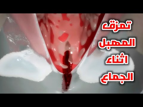 تمزق المهبل اثناء الجماع Vaginal Injuries During Intercourse