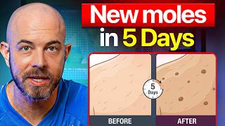Stop Taking Melanotan II... Dermatologist Breaks It Down Stop Taking Melanotan II... Dermatologist Breaks It Down