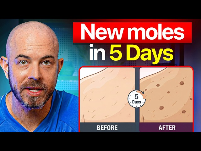 melanotan rosacea Stop Taking Melanotan II... Dermatologist Breaks It Down