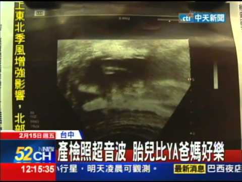 20130215【中天】產檢照超音波　胎兒比YA爸媽好樂