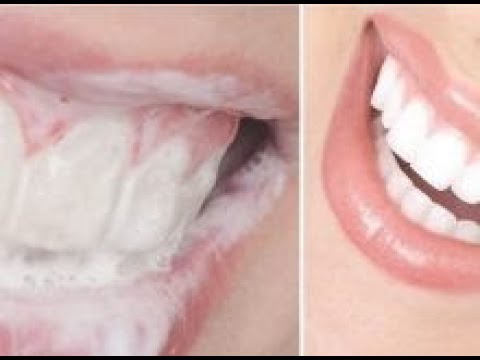 remedios naturales para la artritis Elimina El Sarro, Gingivitis Y Blanquea Tus Dientes Con Esta Receta Casera