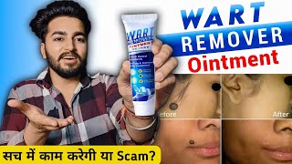 Wart Remover Cream Review Wart Remover Ointment
