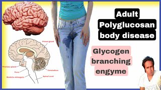 Adult polyglucosan body disease के लक्षण  , कारण । GBE1 ( glycogen branching enzyme )