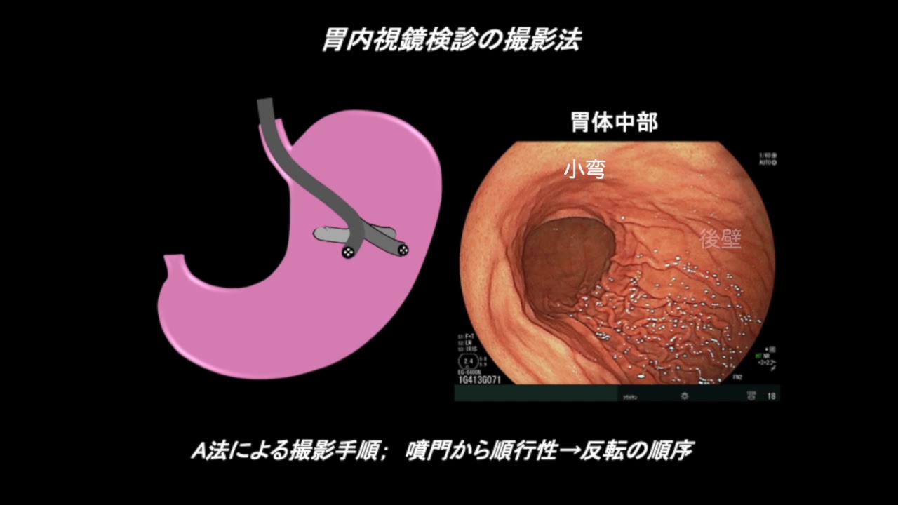 医療従事者の皆様へ ～ 参考情報 ～   医療新聞 内視鏡