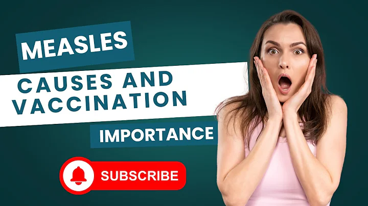 Measles - causes, symptoms, diagnosis, treatment, pathology