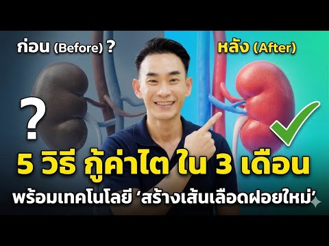 5 วิธี กู้ค่าไต ใน 3 เดือน! พร้อมเทคโนโลยี สร้างเส้นเลือดฝอยใหม่