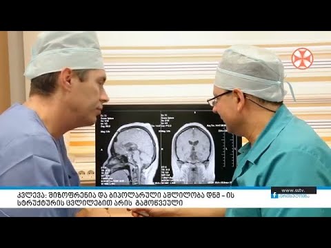 კვლევა: შიზოფრენია და ბიპოლარული აშლილობა დნმ – ის სტრუქტურის ცვლილებით არის გამოწვეული