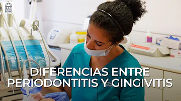 ¿Cómo diferenciar la gingivitis de la periodontitis?