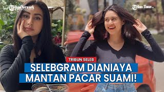 Sosok Afifah Riyad, Selebgram Unggah Potret Wajah Penuh Luka, Diduga Dianiaya Mantan Pacar Suami