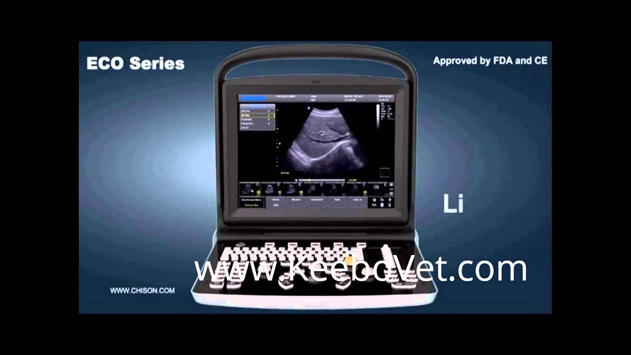 CHISON ECO series  Ultrasound Introduction