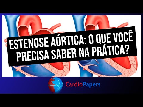 Estenose aórtica: o que você precisa saber na prática?