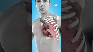 How To Survive A Chest Stab