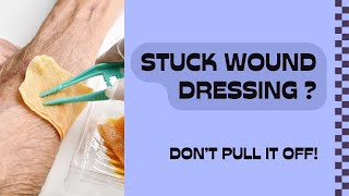 Never Pull Off Stuck Wound Dressing, do this instead!