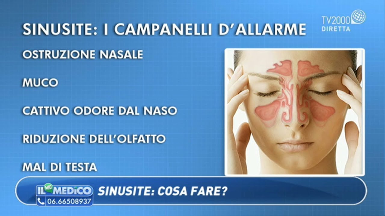 Il Mio Medico - Sinusite: cosa fare?