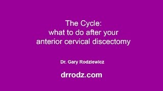 The Cycle - what to do after anterior cervical discectomy (ACDF)